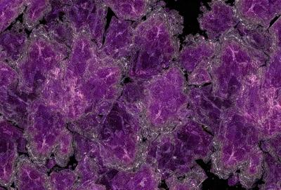 The primary subject of the image is a close-up of a purple substance, which appears to be a pattern or a texture. The setting is a dark background, which contrasts with the purple substance. The visual style is a combination of a photo and digital art, creating a unique and intriguing appearance. The colors and mood of the image are predominantly purple, giving it a somewhat mysterious and captivating atmosphere.