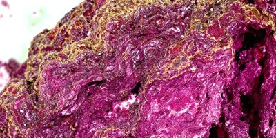The primary subject of the image is a close-up of a purple rock with a gold-like texture. The rock appears to be a piece of coral, and it is set against a purple background. The visual style of the image is a close-up, which emphasizes the details of the rock's texture. The colors and mood of the image are predominantly purple, which gives the scene a calm and serene atmosphere.
